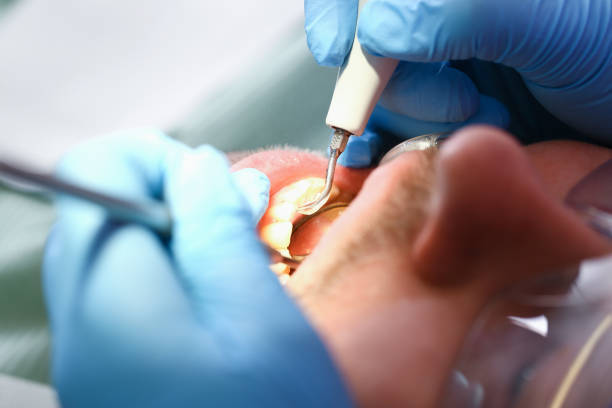 Best Emergency Gum Treatment in Medford, WI