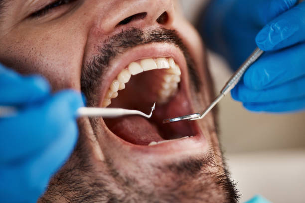 Best Emergency Treatment for Dental Infections or Abscesses in Medford, WI